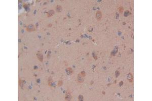 Immunohistochemistry (IHC) image for anti-Glycogen Synthase Kinase 3 alpha (GSK3a) (AA 122-416) antibody (ABIN1868279)