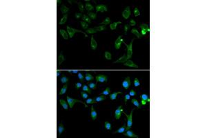 Immunofluorescence analysis of U2OS cells using TOLLIP antibody. (TOLLIP antibody)