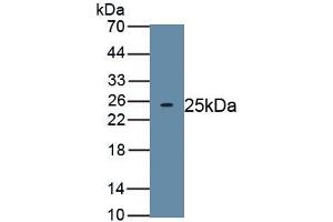 Detection of Recombinant TITF1, Human using Polyclonal Antibody to Thyroid Transcription Factor 1 (TITF1) (NKX2-1 antibody)