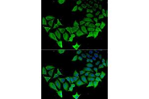 Immunofluorescence analysis of HeLa cell using APLP1 antibody. (APLP1 antibody)
