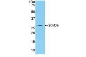 Western blot analysis of recombinant Human IRAK4. (IRAK4 antibody  (AA 189-427))