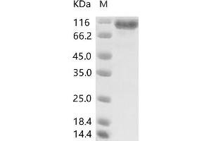 MERS-Coronavirus Spike Protein (MERS-CoV S) protein (His tag)