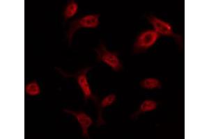 ABIN6274555 staining COLO205 by IF/ICC. (YBX2 antibody  (C-Term))
