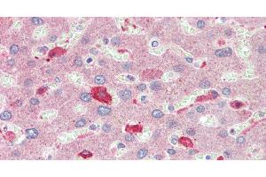 Immunohistochemistry of paraffin-embedded Liver tissue using BCAT1 Polyclonal Antibody at dilution of 1:100. (BCAT1 antibody)