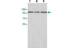 Western blot analysis of HepG2 (Lane 1), human fetal liver (Lane 2) and brain lysate (Lane 3) with CTNNA2 polyclonal antibody  at 1:500 dilution. (CTNNA2 antibody)