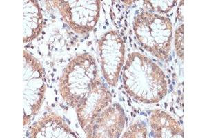 Immunohistochemistry of paraffin-embedded Human stomach using PRMT7 Polyclonal Antibody at dilution of 1:200 (40x lens). (PRMT7 antibody)