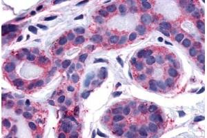 Human Lobular Epithelium (formalin-fixed, paraffin-embedded) stained with PTK2 antibody ABIN213411 at 6 ug/ml followed by biotinylated goat anti-rabbit IgG secondary antibody ABIN481713, alkaline phosphatase-streptavidin and chromogen. (FAK antibody  (C-Term))