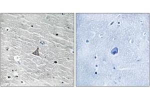 Immunohistochemistry analysis of paraffin-embedded human brain tissue, using VHL (Ab-68) Antibody. (VHL antibody  (AA 34-83))