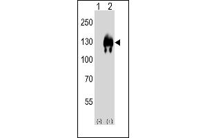 Western blot analysis of (arrow) using rabbit polyclonal EN Antibody (Center) (ABIN650746 and ABIN2839471).