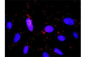 anti-Guanine Nucleotide Binding Protein (G Protein), beta 5 (GNB5) (AA 1-90) antibody