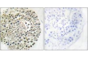 Immunohistochemistry analysis of paraffin-embedded human testis, using TRIM16 Antibody.