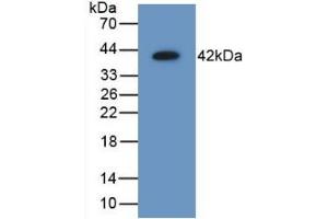 Detection of Recombinant AIMP1, Mouse using Polyclonal Antibody to Aminoacyl tRNA Synthetase Complex Interacting Multifunctional Protein 1 (AIMP1) (AIMP1 antibody  (AA 2-310))