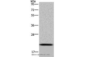 Western blot analysis of Raji cell, using NDUFAF4 Polyclonal Antibody at dilution of 1:300