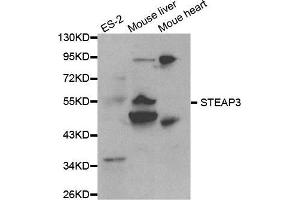 Western blot analysis of extracts of various cell lines, using STEAP3 antibody. (STEAP3 antibody  (AA 1-180))