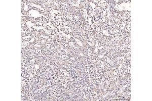 IHC analysis of ANGPT2 using anti-ANGPT2 antibody (ABIN3043725). (Angiopoietin 2 antibody  (AA 19-348))