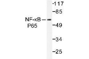 Western blot (WB) analysis of NFκB-p65 antibody in extracts from HeLa cells. (NF-kB p65 antibody)