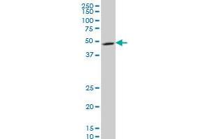 NDUFV1 monoclonal antibody (M01), clone 4A7 Western Blot analysis of NDUFV1 expression in A-431