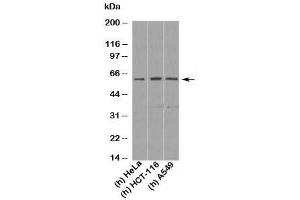 Western blot testing of human samples with KLF4 antibody at 1 ug/ml. (KLF4 antibody  (N-Term))