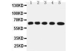 Anti-Solute carrier family 22 member 5 antibody, Western blotting Lane 1: Rat Kidney Tissue Lysate Lane 2: Rat Skeletal Muscles Tissue Lysate Lane 3: Mouse Liver Tissue Lysate Lane 4: HEPA Cell Lysate Lane 5: NIH3T3 Cell Lysate (SLC22A5 antibody  (C-Term))