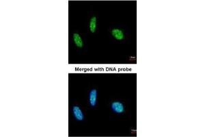 ICC/IF Image Immunofluorescence analysis of paraformaldehyde-fixed HeLa, using RBM15, antibody at 1:200 dilution. (RBM15 antibody)