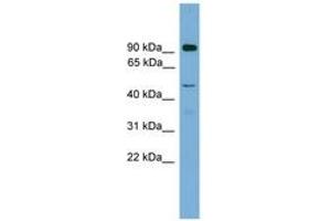Image no. 1 for anti-Zinc Finger Protein 2, Y Linked (ZFY2) (AA 251-300) antibody (ABIN6744556) (ZFY2 antibody  (AA 251-300))