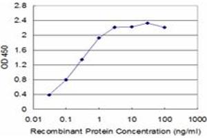 Detection limit for recombinant GST tagged SLC11A1 is approximately 0. (SLC11A1 antibody  (AA 308-350))