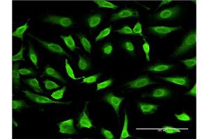 Immunofluorescence of monoclonal antibody to SMAD7 on HeLa cell. (SMAD7 antibody  (AA 160-260))