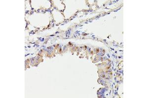 Immunohistochemistry of paraffin-embedded mouse lung using CDC23 antibody (ABIN7266248) at dilution of 1:100 (40x lens). (CDC23 antibody  (AA 50-150))