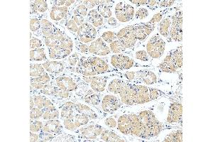 IHC analysis of SLC25A23 using anti-SLC25A23 antibody (ABIN7600165). (SLC25A23 antibody  (AA 16-189))