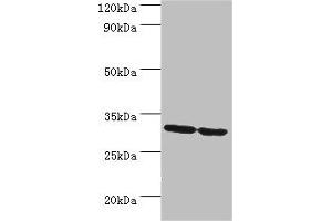 Western blot All lanes: PNP antibody at 10 μg/mL Lane 1: Jurkat whole cell lysate Lane 2: K562 whole cell lysate Secondary Goat polyclonal to rabbit IgG at 1/10000 dilution Predicted band size: 32 kDa Observed band size: 32 kDa (PNP antibody  (AA 1-289))