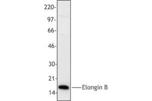 Image no. 1 for anti-Transcription Elongation Factor B (SIII), Polypeptide 2 (18kDa, Elongin B) (TCEB2) antibody (ABIN205406)