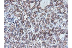 Image no. 1 for anti-Crystallin, Zeta, Homolog antibody (ABIN1497654) (CRYZL1 antibody)