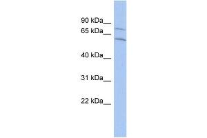 WB Suggested Anti-CNOT2 Antibody Titration:  0. (CNOT2 antibody  (Middle Region))