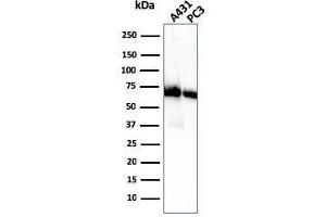 Western Blot Analysis of A431 and PC-3 cell lysate using CD73 Mouse Monoclonal Antibody (NT5E/2505).