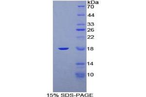 SDS-PAGE analysis of Rat Progesterone Receptor Protein. (Progesterone Receptor Protein (PGR))