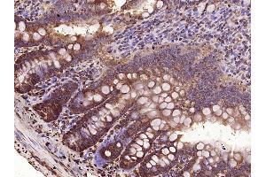 Paraformaldehyde-fixed, paraffin embedded Rat small intestine Antigen retrieval by boiling in sodium citrate buffer (pH6. (VEGFC antibody  (AA 321-415))