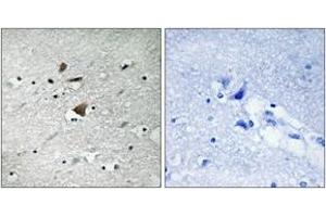 Immunohistochemistry analysis of paraffin-embedded human brain tissue, using APC1 (Ab-355) Antibody. (APC1 antibody  (AA 321-370))