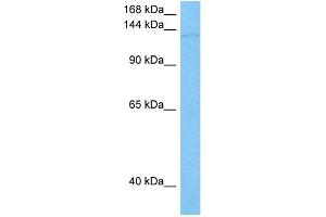 Host:  Mouse  Target Name:  SLC12A2  Sample Tissue:  Mouse Testis  Antibody Dilution:  1ug/ml (SLC12A2 antibody  (N-Term))