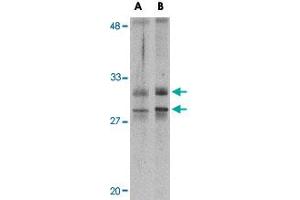 Western blot analysis of METTL7A in MCF-7 cell lysate with METTL7A polyclonal antibody  at 2 ug/mL . (METTL7A antibody  (Internal Region))
