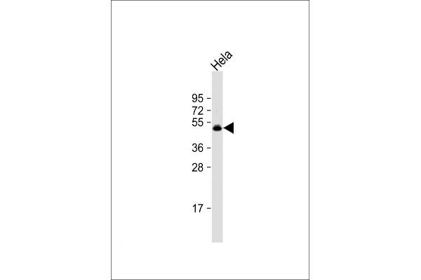 CEPT1 antibody  (N-Term)
