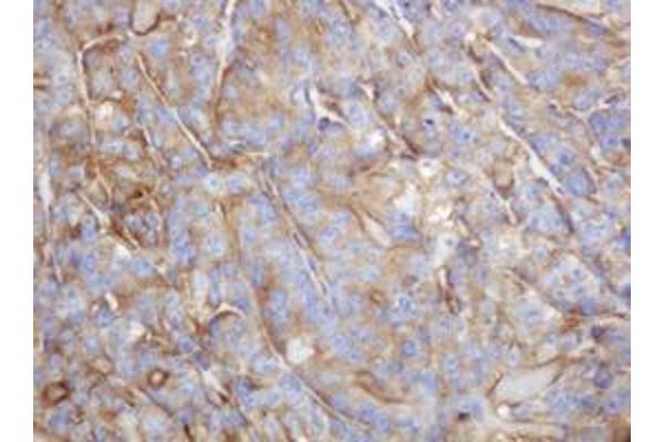 TAPBPL antibody