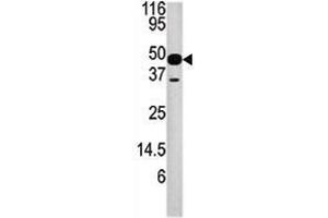 Image no. 1 for anti-Nucleoporin 54kDa (NUP54) (AA 304-334), (Center) antibody (ABIN357242) (NUP54 antibody  (Center))