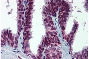 Immunohistochemistry (Formalin-fixed Paraffin-embedded Sections) (IHC (fp)) image for anti-Mdm2, p53 E3 Ubiquitin Protein Ligase Homolog (Mouse) (MDM2) (pSer395) antibody (ABIN6747202)