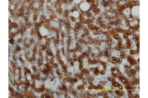 Immunoperoxidase of monoclonal antibody to KRT18 on formalin-fixed paraffin-embedded human liver tissue. (Cytokeratin 18 antibody  (AA 1-430))