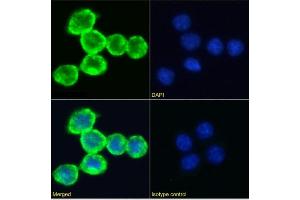 Immunofluorescence staining of RAW 264. (Recombinant Transferrin Receptor antibody)
