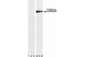 Western blot analysis of Tyk2 (pY1054/pY1055) in human Burkitt’s lymphoma.