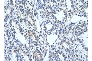 Rabbit Anti-KRT17 Antibody       Paraffin Embedded Tissue:  Human alveolar cell   Cellular Data:  Epithelial cells of renal tubule  Antibody Concentration:   4. (KRT17 antibody  (C-Term))