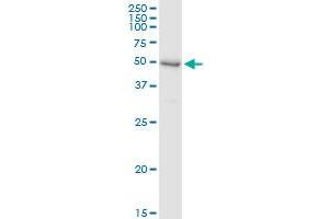 Immunoprecipitation of SHPK transfected lysate using anti-SHPK MaxPab rabbit polyclonal antibody and Protein A Magnetic Bead , and immunoblotted with SHPK purified MaxPab mouse polyclonal antibody (B01P) . (SHPK antibody  (AA 1-478))