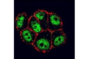 Immunofluorescence (IF) image for anti-Nuclear Factor of kappa Light Polypeptide Gene Enhancer in B-Cells Inhibitor, alpha (NFKBIA) (AA 12-41) antibody (ABIN3032048)