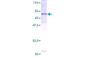 ACADL Protein (AA 1-430) (GST tag)